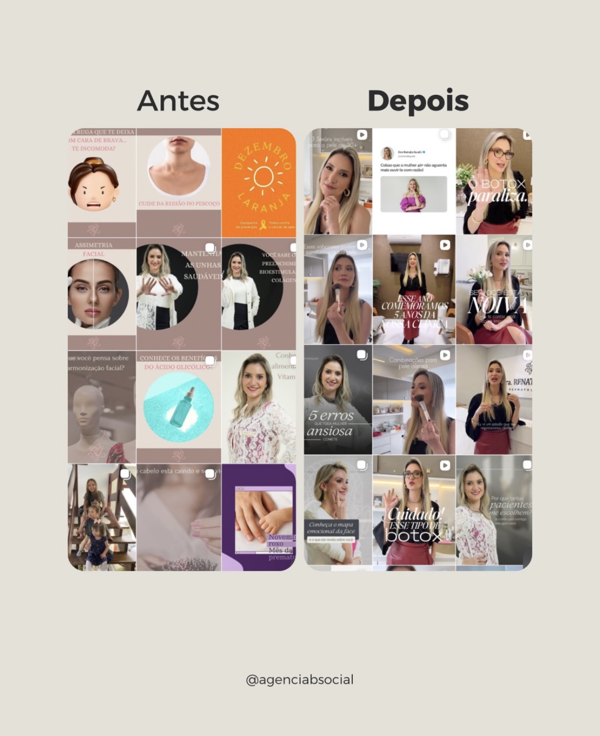 Antes e depois do feed de Instagram de uma Dermatologista - transformação visual completa pela BSocial